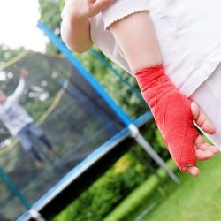 Ein Mädchen mit Gipsverband an der Hand schaut einem Kind auf dem Trampolin zu.